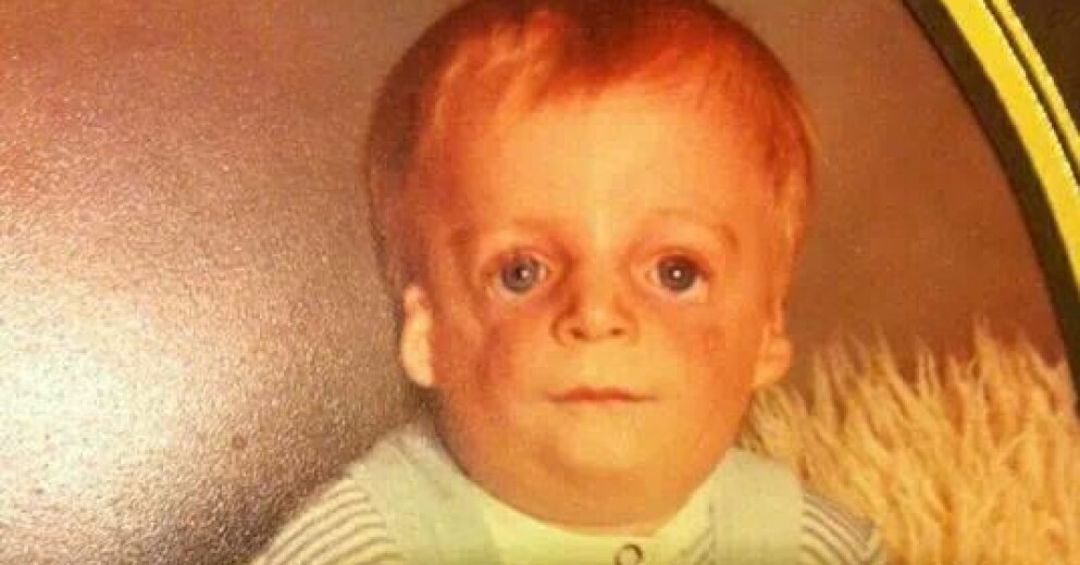 Jono Lancaster föddes med sjukdomen Treacher Collins syndrom. Föräldrarna tyckte att han var för full och ville inte ha något med sitt barn att göra. De bestämde sig för att adoptera bort honom. Jono Lancaster