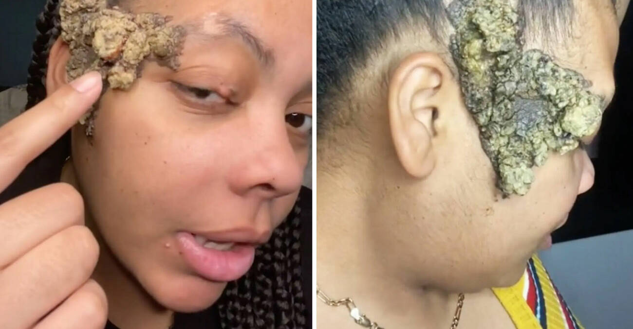 Jordan, 24, försökte dölja den hemska massan under hennes hår