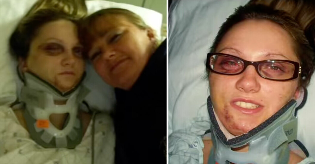<strong>På sjukhuset fick mamma Rhonda berätta för sin blåslagna dotter vad som hänt och att hon var förlamad från nacken och ner.</strong> På sjukhuset fick mamma Rhonda berätta att Josey var förlamad från nacken.