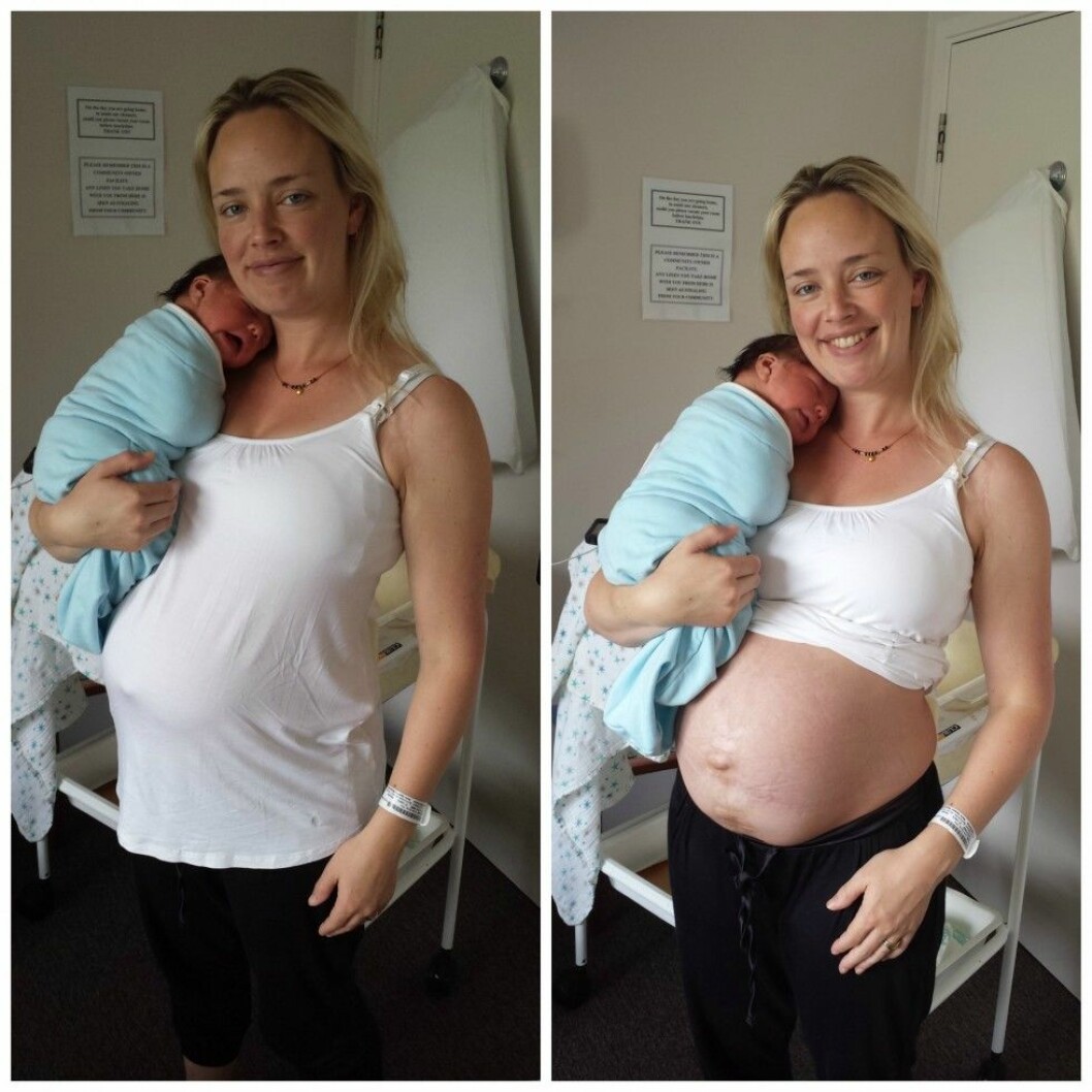 Via: <a href="http://juliebhosale.co.nz/my-real-postpartum-body/" target="_blank">Juliebhosale.com</a> julie2