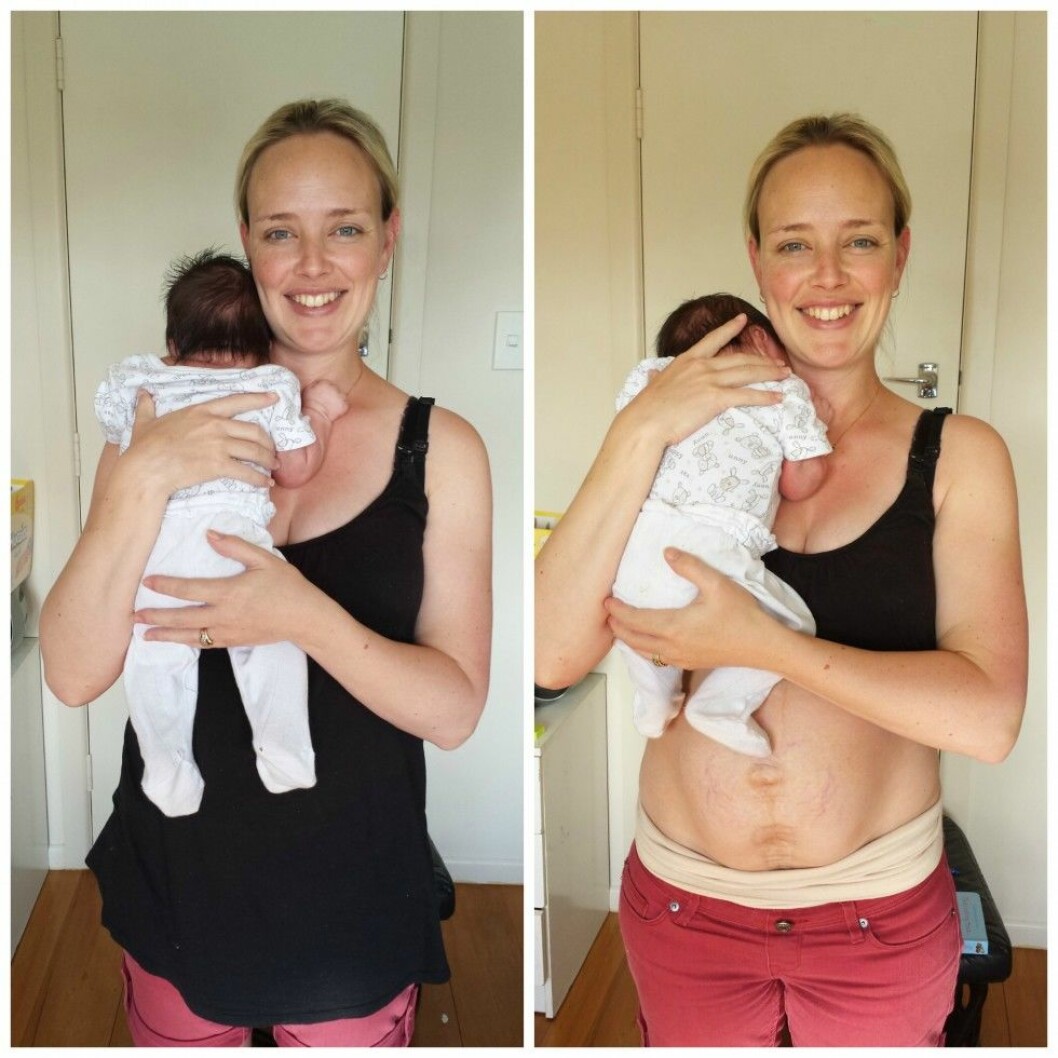 Via: <a href="http://juliebhosale.co.nz/my-real-postpartum-body/" target="_blank">Juliebhosale.com</a> julie4