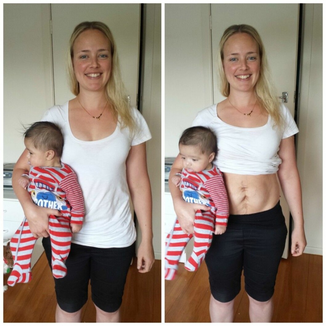 Via: <a href="http://juliebhosale.co.nz/my-real-postpartum-body/" target="_blank">Juliebhosale.com</a> julie6