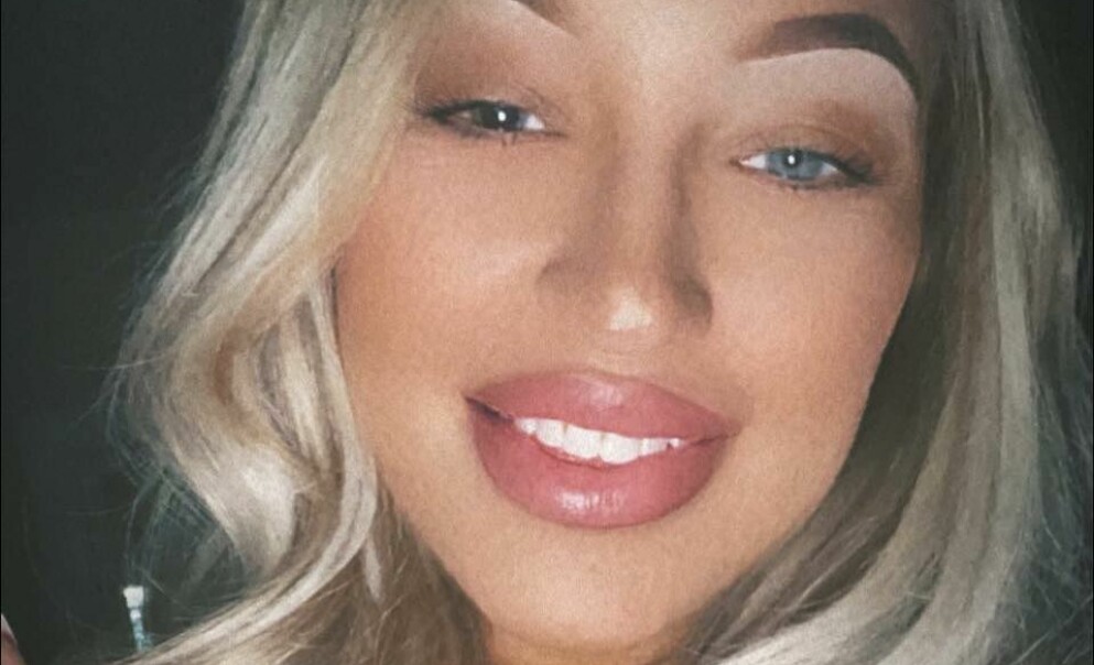 Karly Cox vill nu uppmana andra att ta sina ögonproblem på allvar. Karly Cox