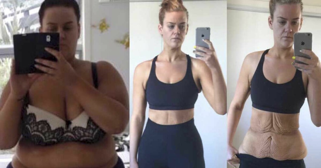 De påstod att hennes viktnedgång var fejk – här visar hon näthatarna