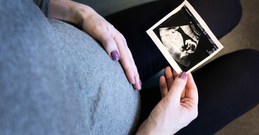 Kvinna håller på sin gravidmage och ett ultraljud i handen.