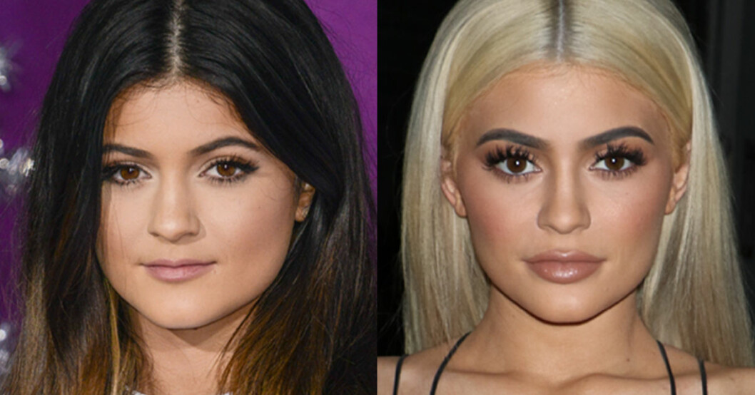 Kylie då 2013 och nu 2016. Kylie då 2013 och nu 2016.