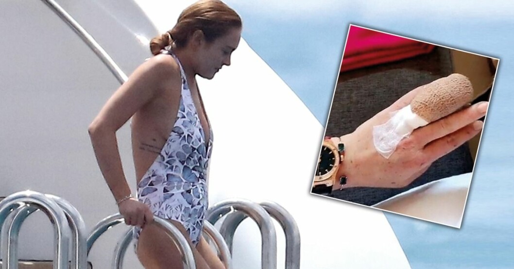 Lindsay Lohans finger slets av i båtolycka