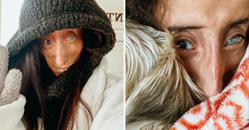 Elizabeth kallas världens fulaste människa.