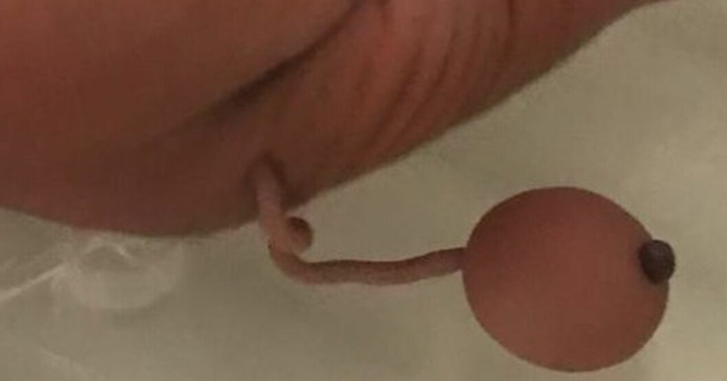 Den ”mänskliga svansen” var tolv centimeter lång och fyra centimeter bred. Mänsklig svans