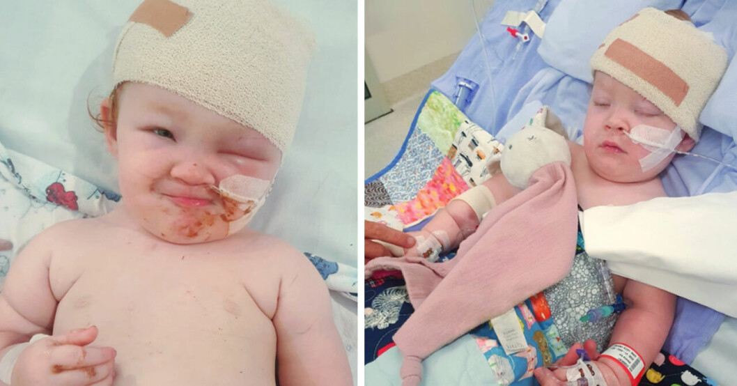 Millie med blod i ansiktet och på handen och Millie i en sjukhussäng med flera slangar kopplade till sig.