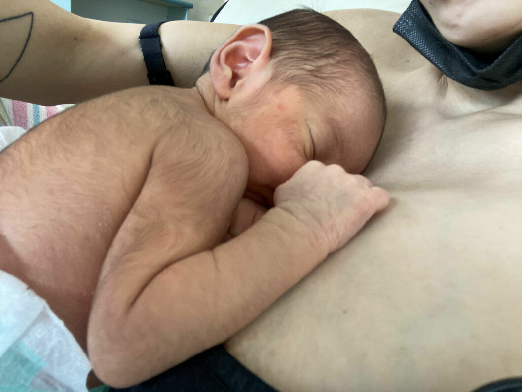 Lilla Teyanas föddes tre veckor för tidigt – med massvis med hår. <em>”När hon kom ut, så såg hon ut som en liten apa”</em>, säger mamman.