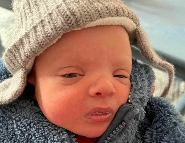 Zander hade väldigt svullna ögon när han var liten men i dag har svullnaden gått ner. Zander med svullna ögon i mössa.