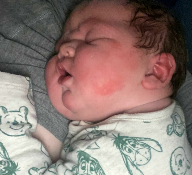 Teddie vägde hela 5,3 kilo när han föddes. Teddie Eden ligger och sover.