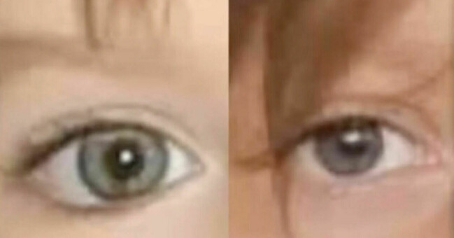 Julia Wendell påstår att hon har samma ögonfel som Madeleine McCann. Ögonfel.