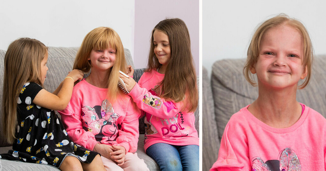 Olivia-Jane, 8, skulle donera sitt hår till välgörenhet men började tappa det – fick peruk av samma organisation.