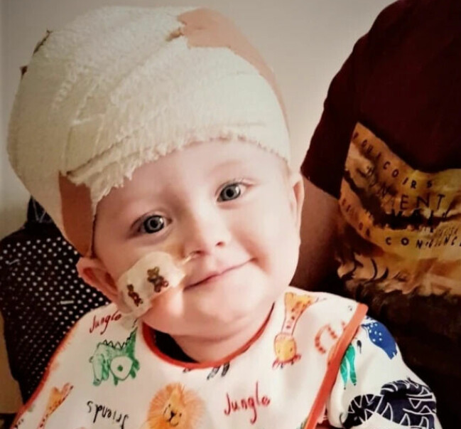 Trots att Oscar har hjärnskador, autism och utvecklas långsamt är han glad. Oscar med bandage på huvudet.