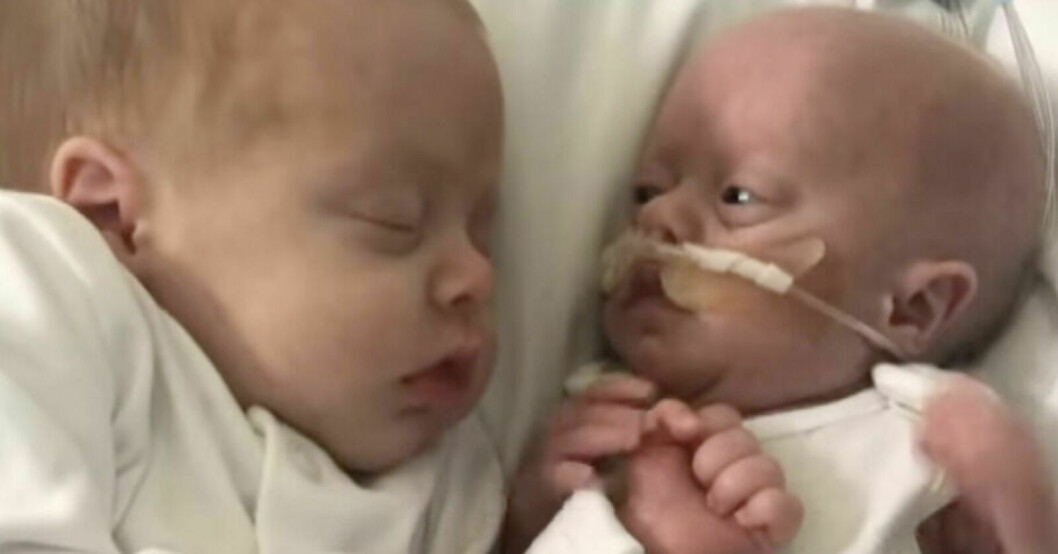 Otis och tvillingbrodern Chester. Mamma Kelly tror att allt gosande kan ha räddat livet på Chester. Otis och Chester