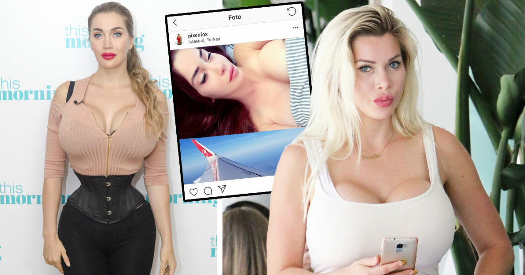 Svenska Pixee Fox har inte uppdaterat sin Instagram på länge och nu oroar sig hennes följare att något har hänt efter hennes senaste skönhetsoperation.
