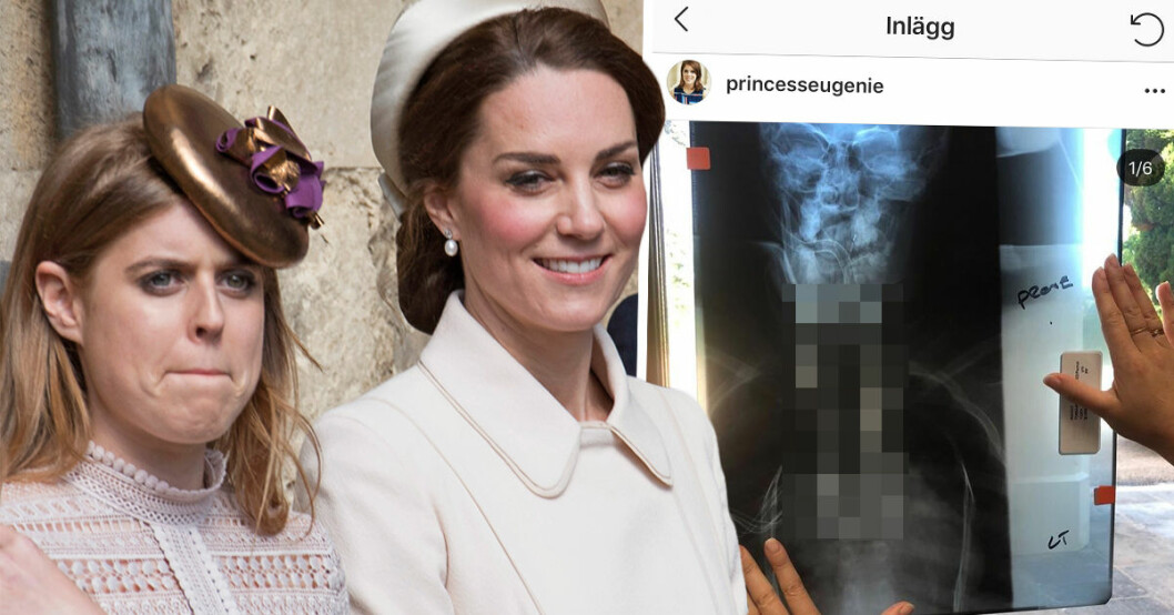 Den brittiska prinsessan Eugenie talar nu ut om sin skolios.