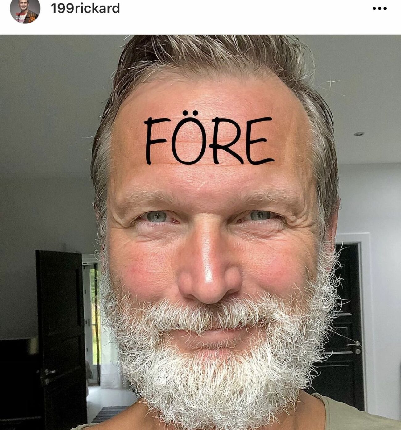 Rickard Sj berg Visar Upp Sitt Nya Utseende P Instagram H nt rickard-sj-berg-visar-upp-sitt-nya-utseende-p-instagram-h-nt