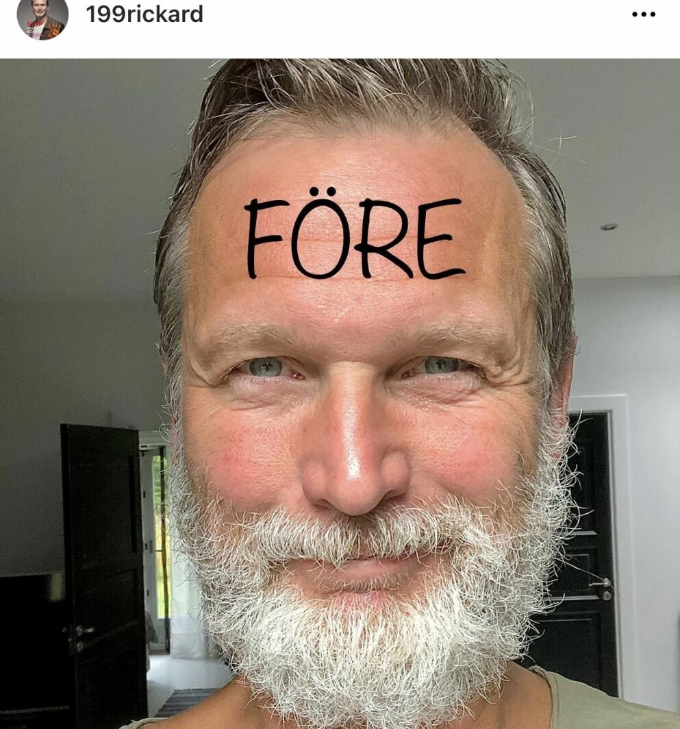 Rickard Sjöberg innan han trimmade sitt skägg.