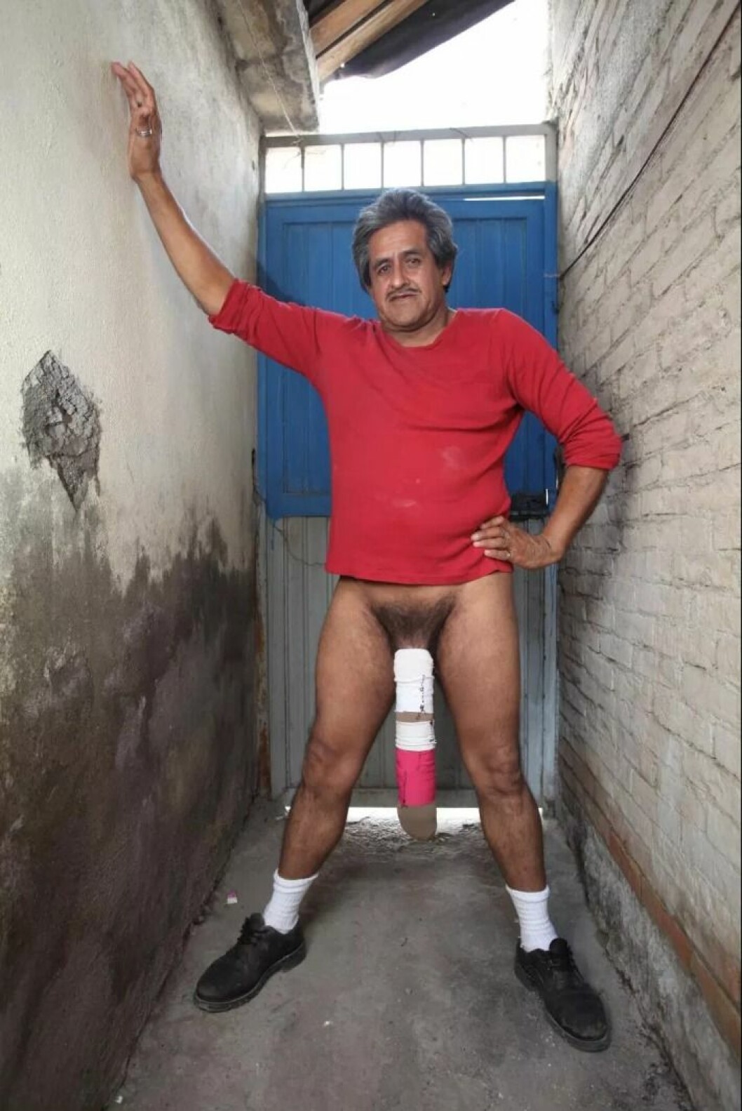 Roberto måste ha sin penis bandagerad. Roberto Esquivel Cabrera penis.