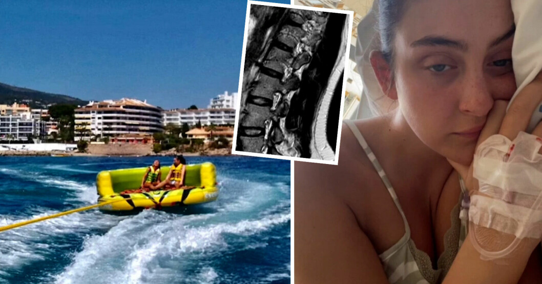 Ellie Ross bröt ryggen när hon testade den populära vattensporten på Mallorca.