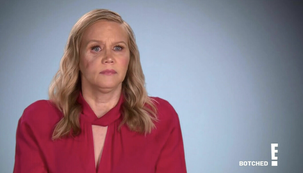 gina Anderson kallar sista operationen för ett ”mirakel”.