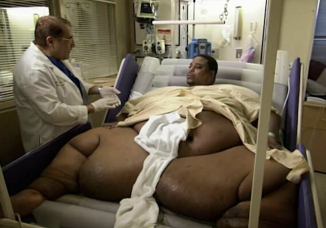 Kenneth, 54, väger 468 kilo.