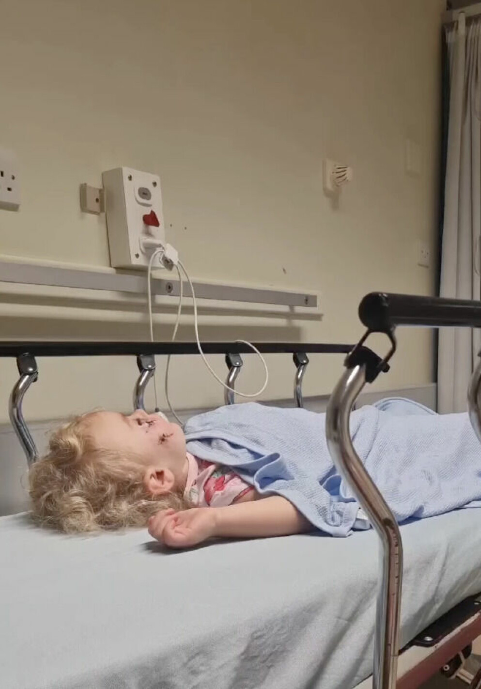 3-åringen kunder ha förlorat ett öga i attacken.