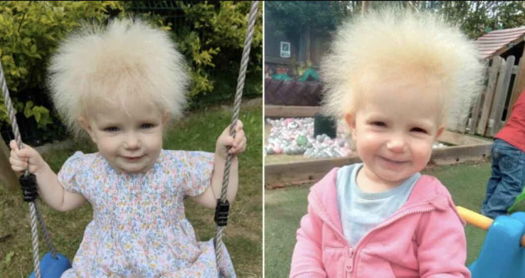 1,5-åriga Layla har fått ett extremt ovanligt syndrom – som gör att hennes hår står rakt upp.