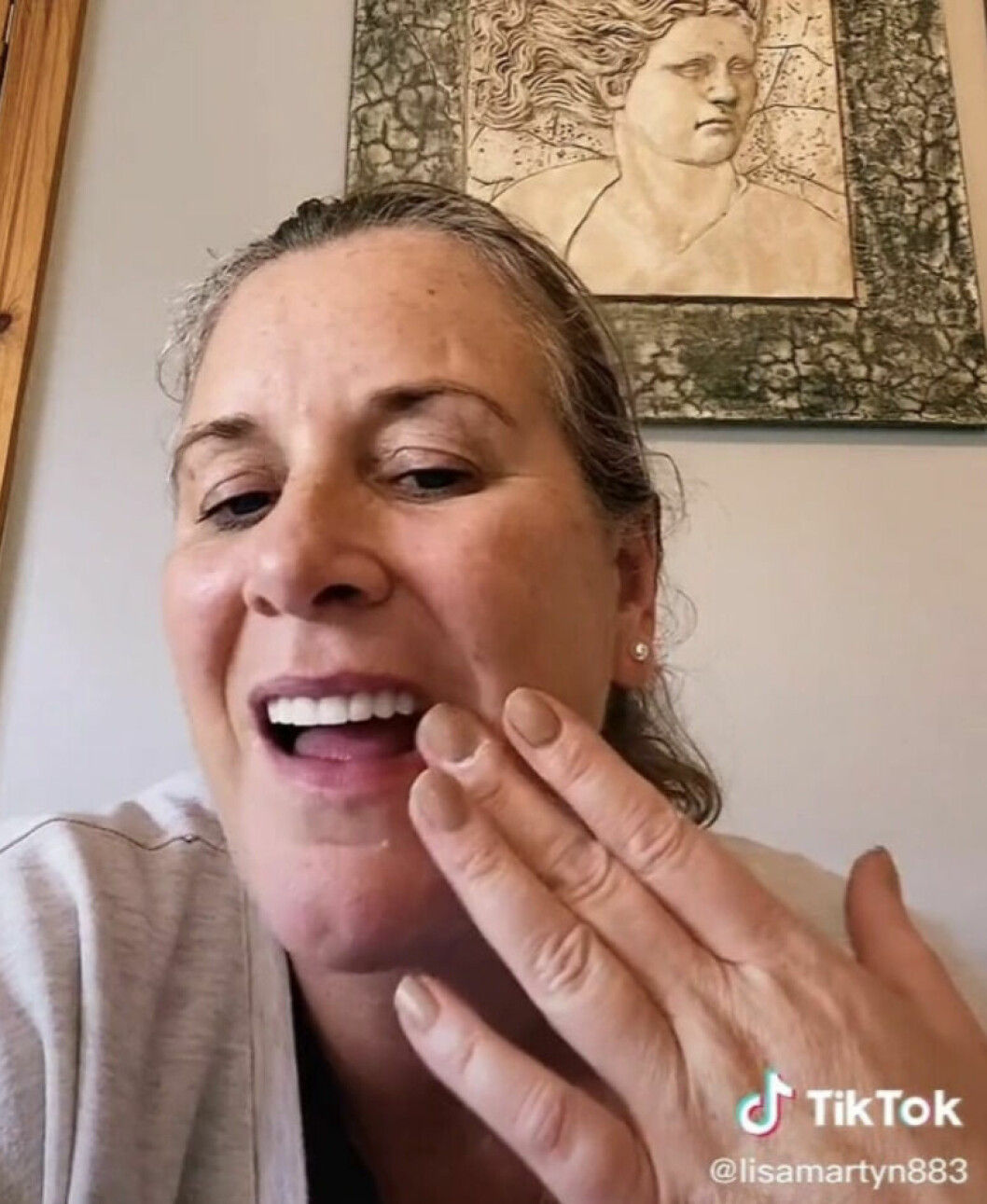 På Tiktok visar Lisa upp sina porslintänder.