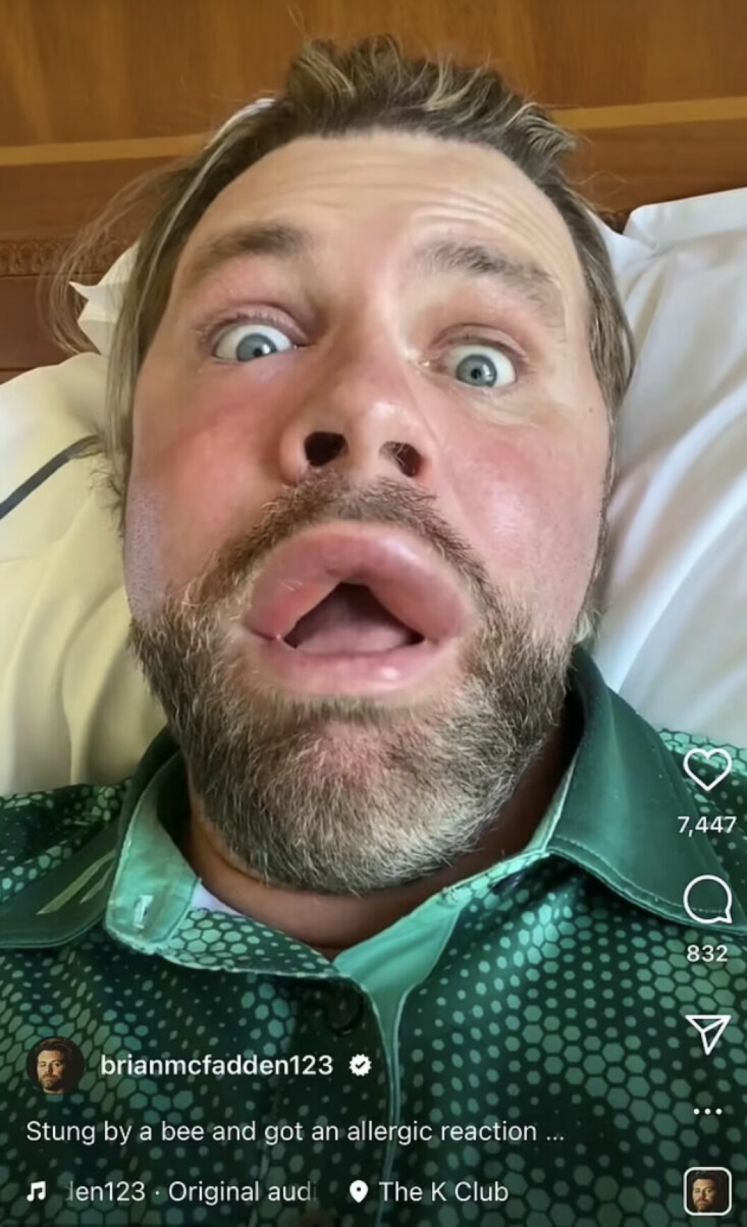 Brian McFadden stucken av en geting.