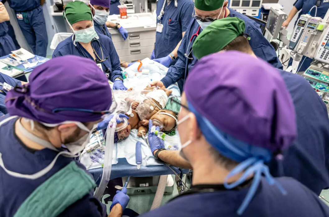 11 timmar lång operation – med över ett dussin läkare.