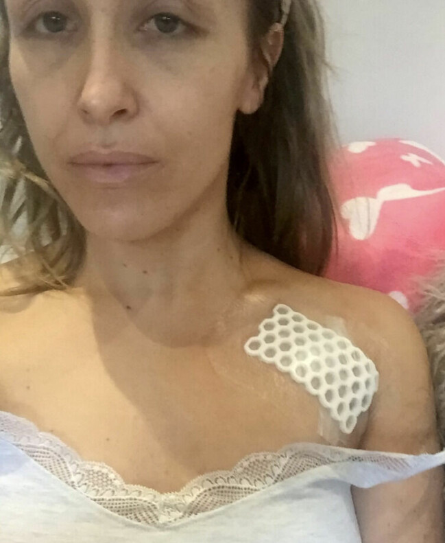 Jade sörjde sitt gamla liv. Jade efter operationen.