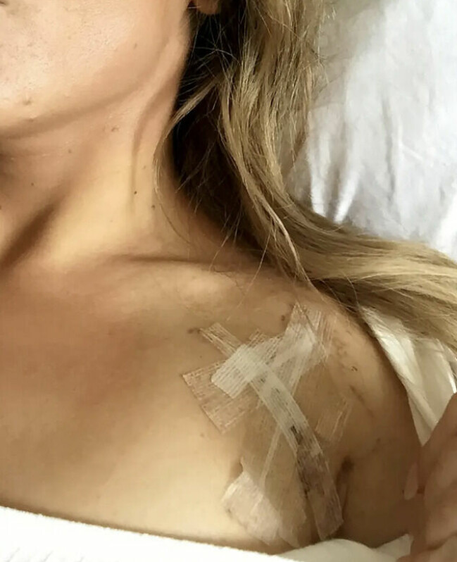 Jade var ung och vältränad, men drabbades ändå av hjärtfel. Jade efter operationen.