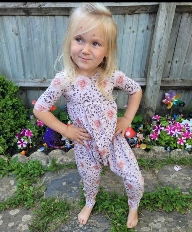 Här syns tydligt att den ena benet är kortare än det andra på Grace. Grace Akerman.