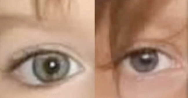Julia Wendell menar att hon och Madeleine McCann har samma ögonfel. Ögonfel