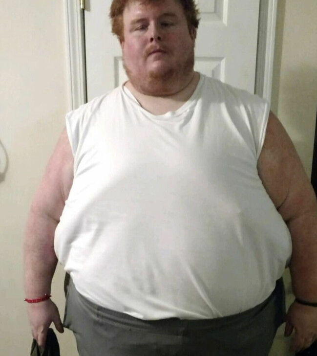 Casey var så stor att han inte kunde torka sig själv efter att ha varit på toaletten. Casey King innan han gick ner i vikt.