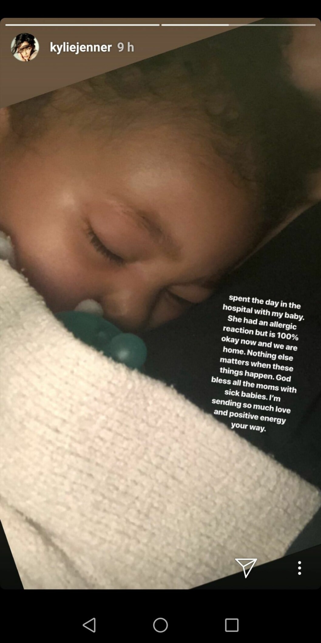 kylie jenners dotter stormi allergisk reaktion