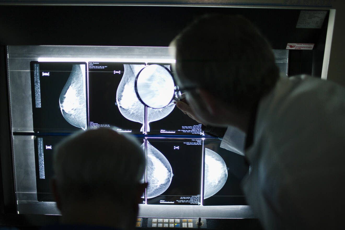 Läkare framför röntgen bilder av ett bröst.