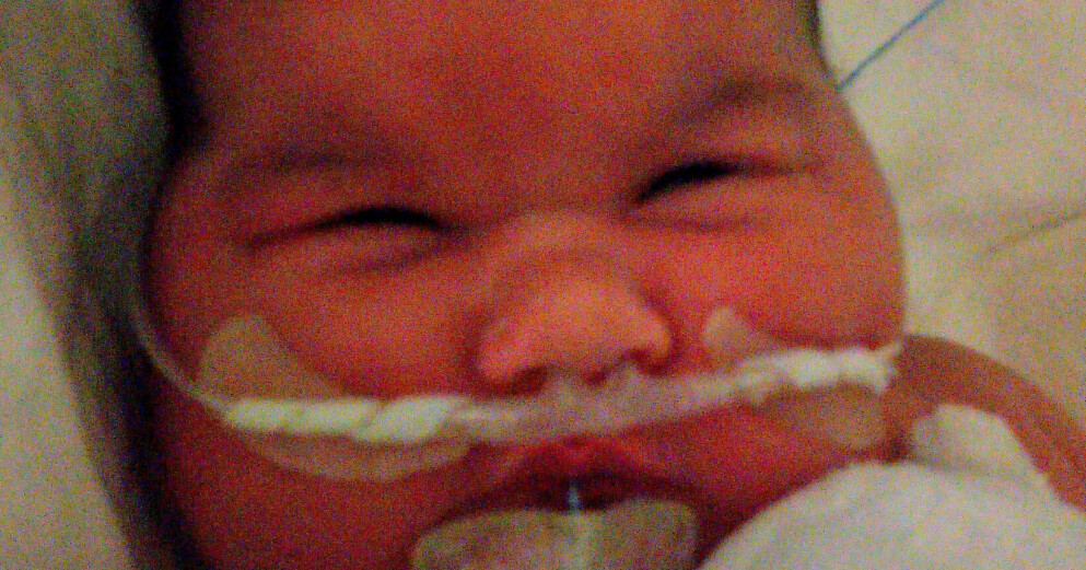 Alpha kallas för en ”flodhästunge” av mamma Cheralls farbror Jason. Han vårdas på neonatalavdelningen men uppges må bra. Alpha