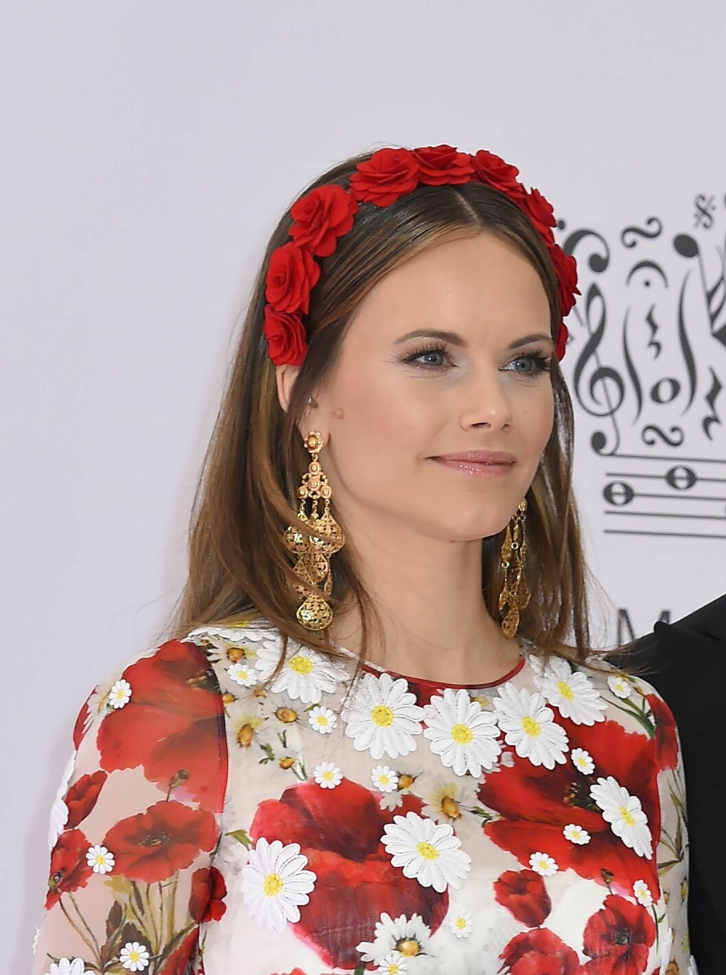 Prinsessan Sofia. Prinsessan Sofia med sina födelsemärken