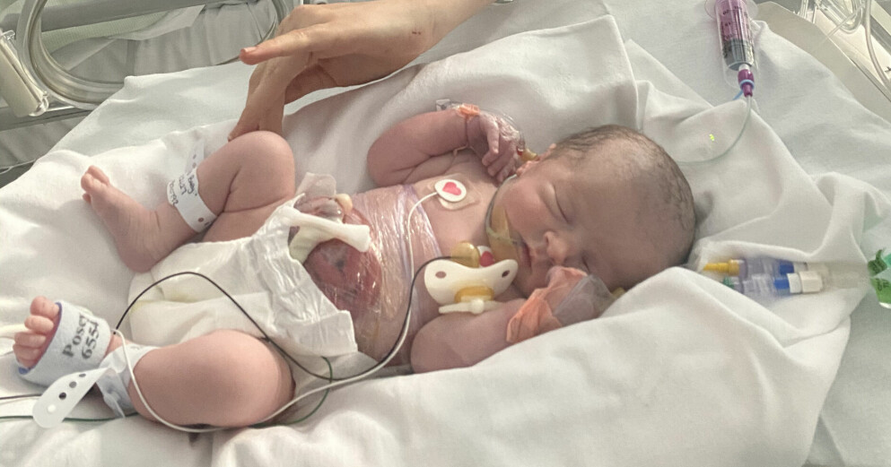 Tarmarna lindades in i plastfolie. Här ligger Millie Woodward på BB i en säng bredvid mamma Laura. Millie Woodward