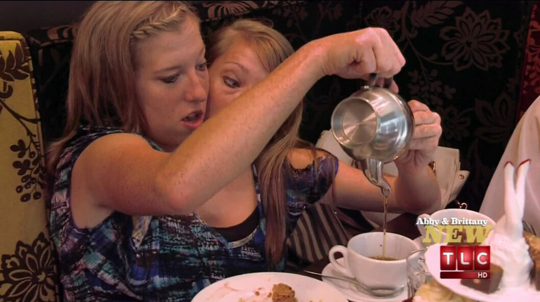 <strong>Tvillingparet Abby och Brittany Hensel är kanske världens mest kända siamesiska tvillingar.</strong> Tvillingparet Abby och Brittany Hensel är kanske världens mest kända siamesiska tvillingar.