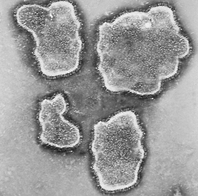 RS-virus ger för det mesta symtom som liknar en vanlig förkylning, men kan vara dödligt för små barn. RS-virus.