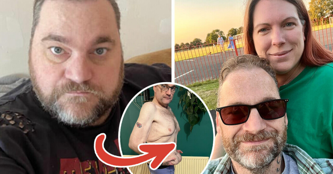40-åringen gick ned över 130 kg – nu ångrar han sig: ”Äcklad”.