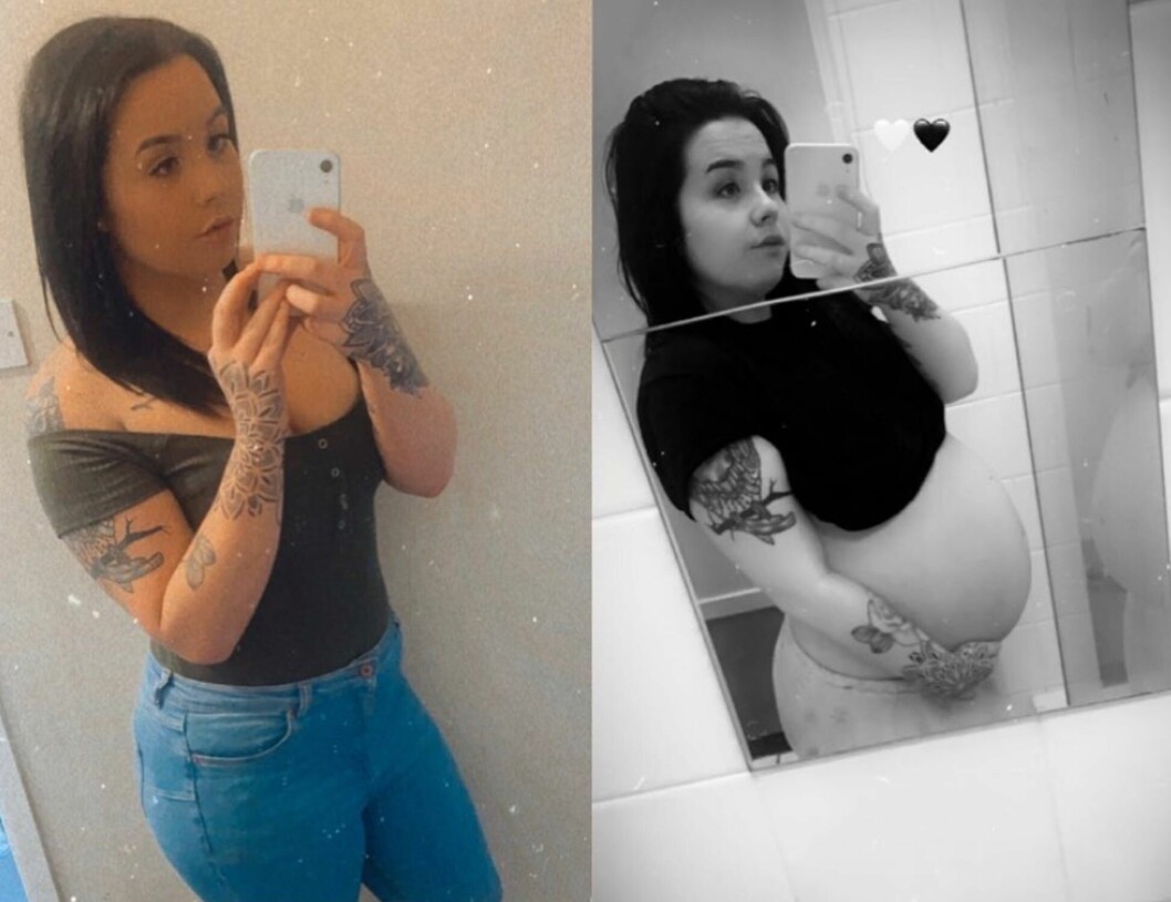 Tog p-piller varje dag – visade sig vara gravid. Och inte bara det, utan gravid med trillingar.