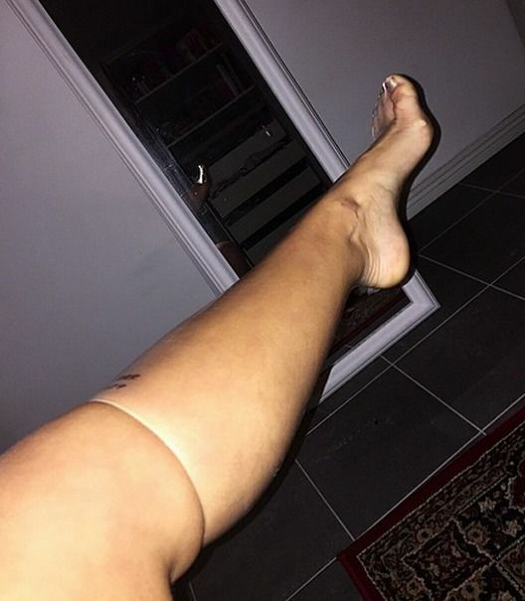 Den hyllade kondombilden. Foto: Instagram Den hyllade kondombilden. Foto: Instagram