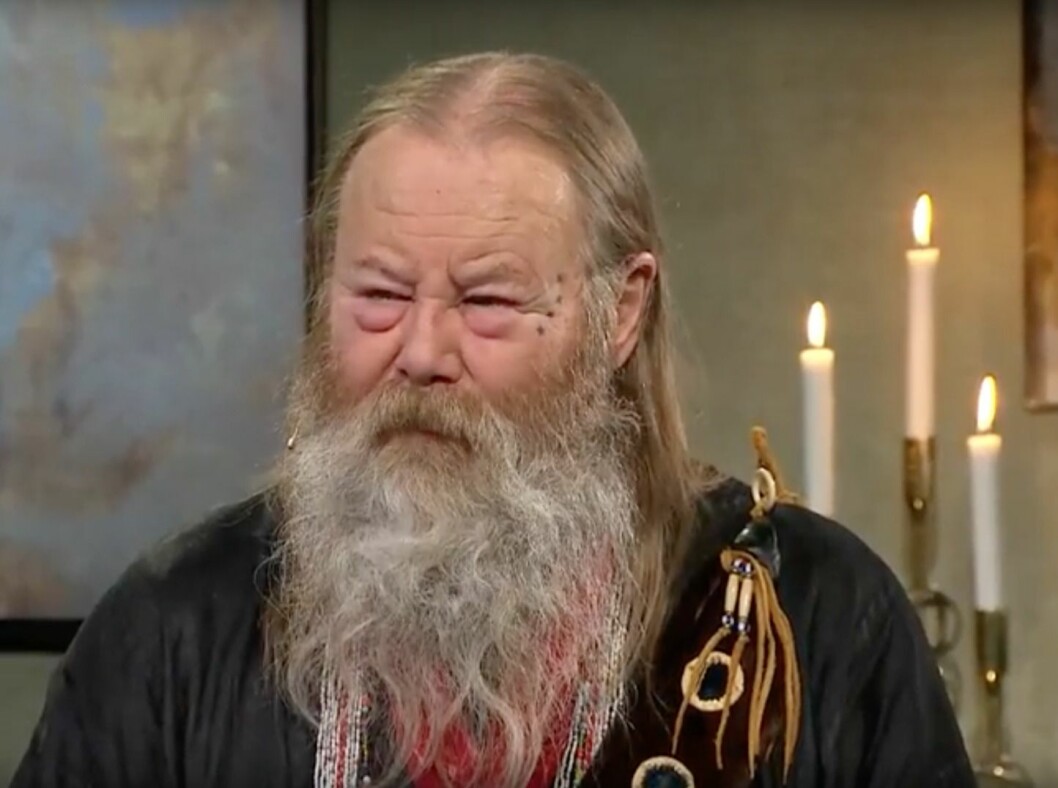 Roger Pontare har stora bulor under ögonen och ingen vet vad det beror på.